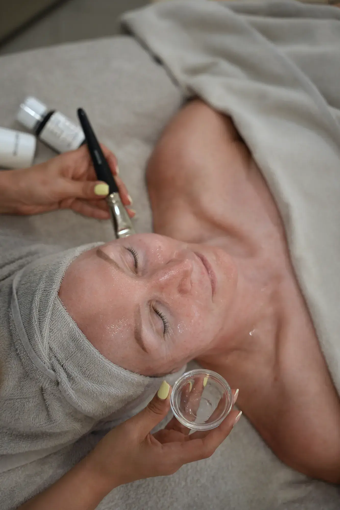 Fruchtsäurepeeling-Behandlung