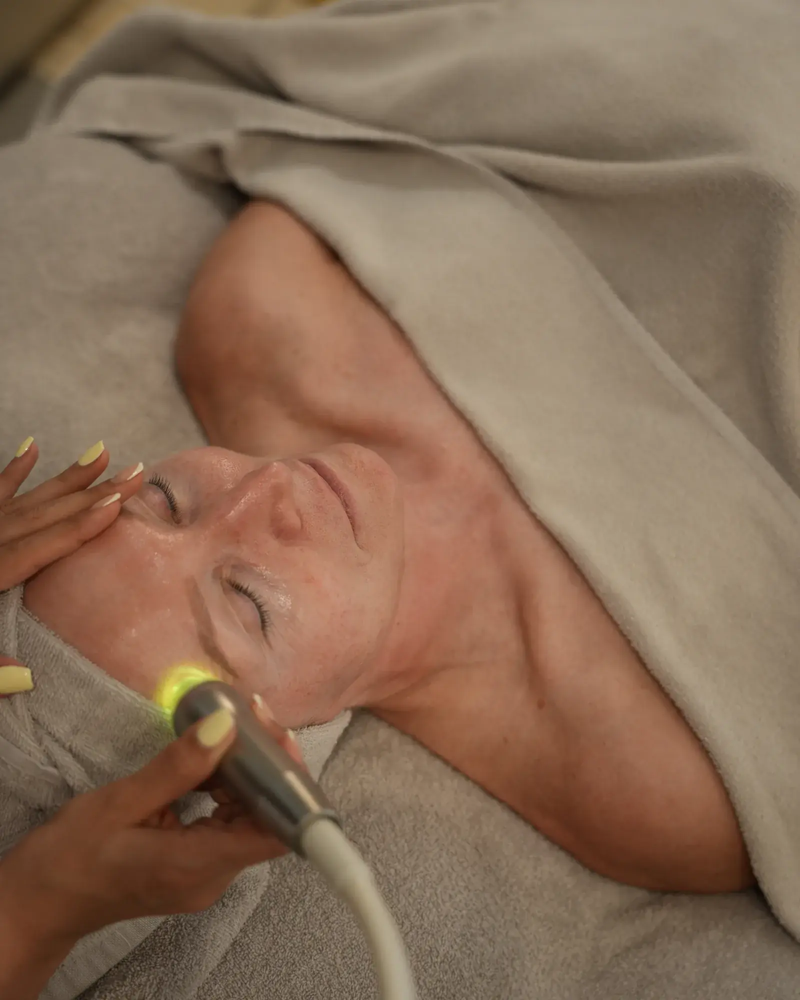 GlowSolution Hydrodermabrasion im House of Shido